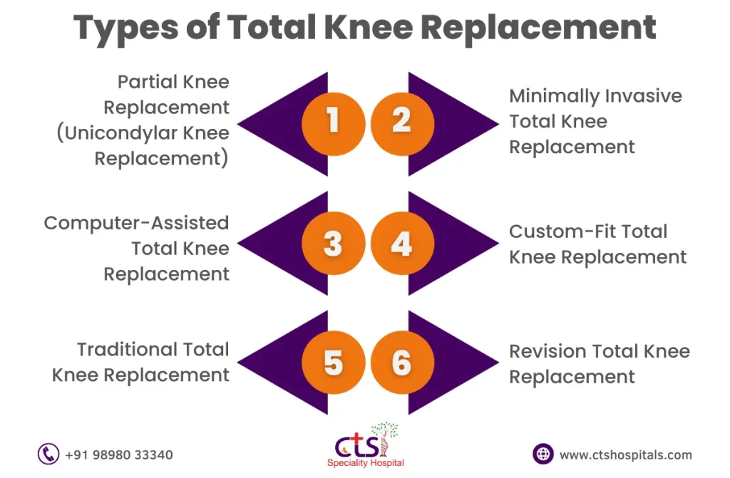 Total Knee Replacement In Chennai