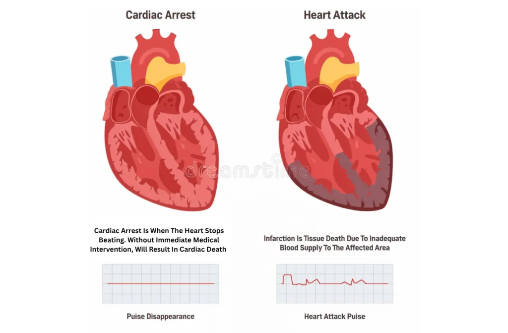 Cardiologist in Chennai