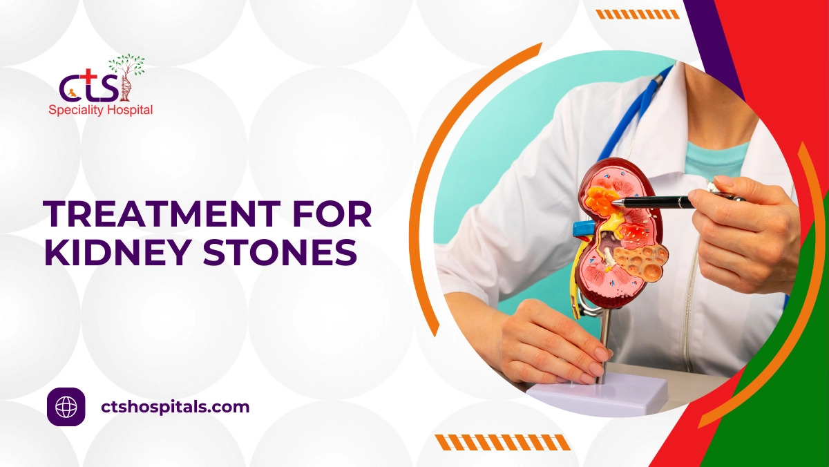 Treatment For Kidney Stones