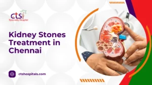 Kidney Stones Treatment In Chennai