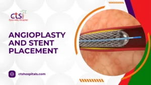 Angioplasty And Stent Placement