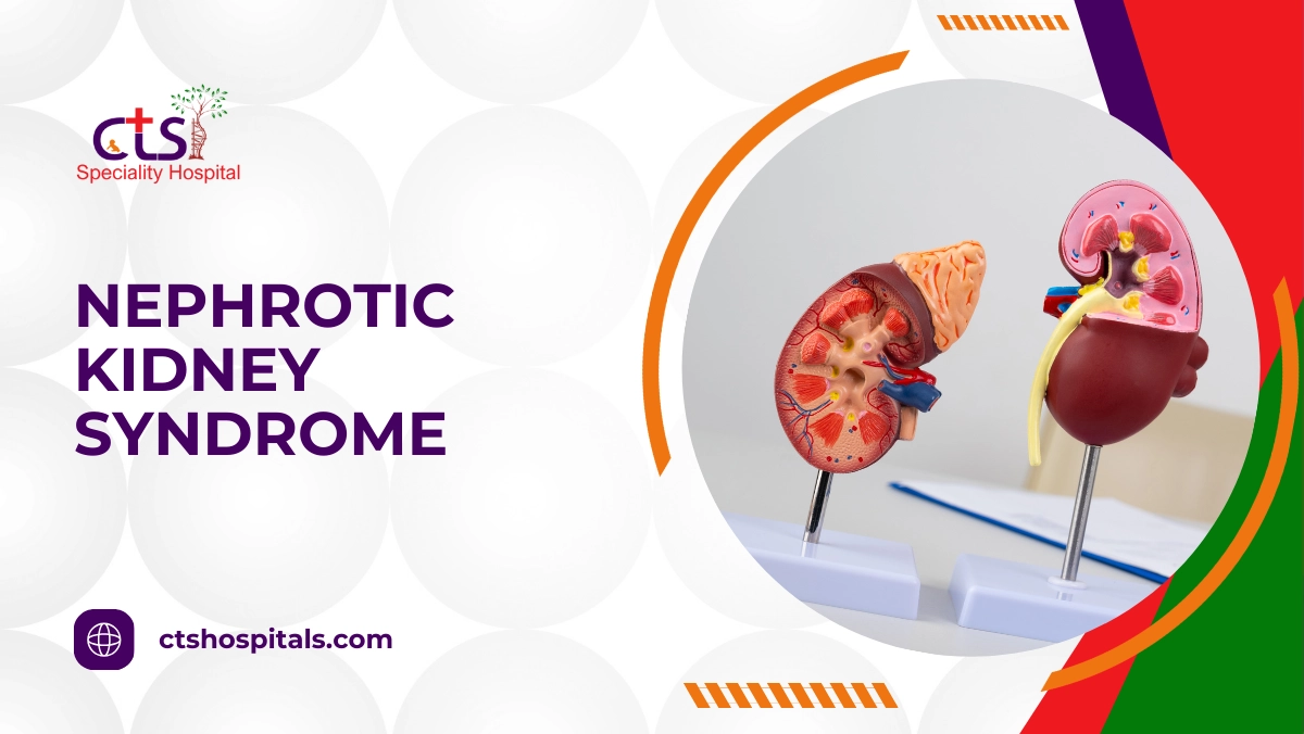 nephrotic kidney syndrome