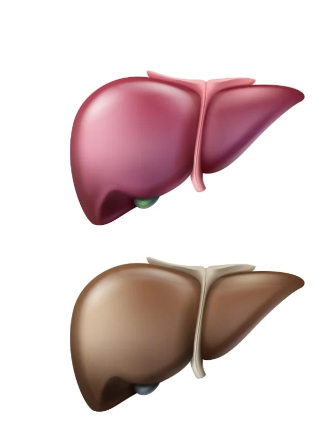 Early Symptoms Of Liver Damage