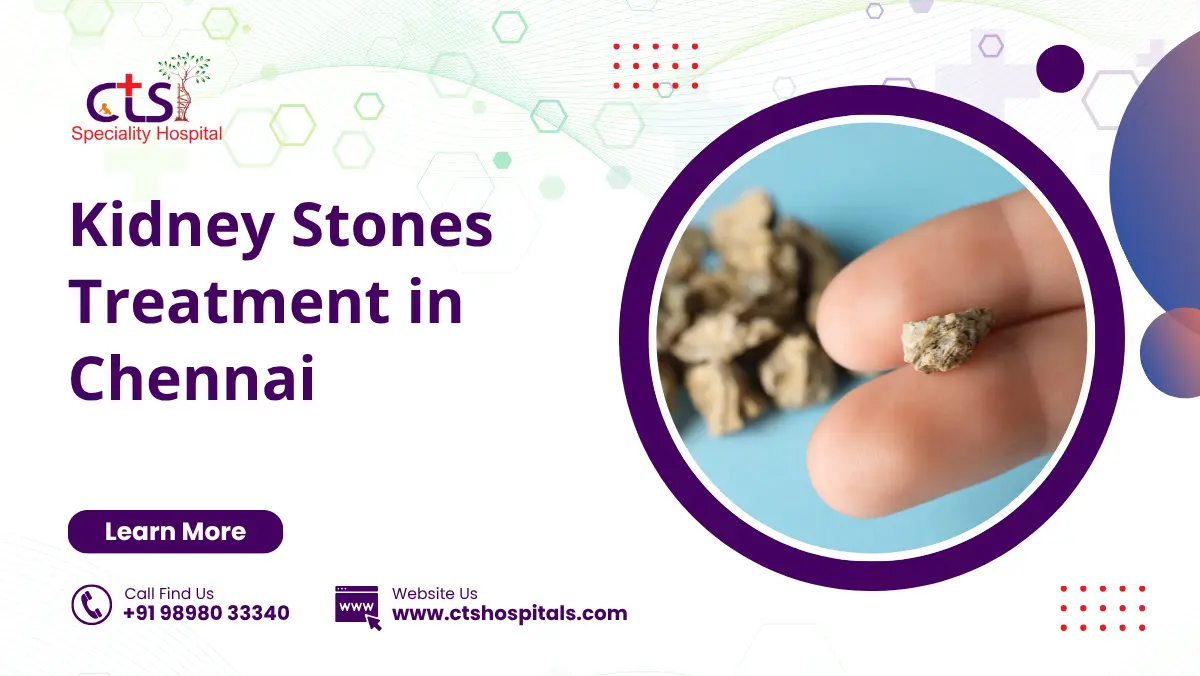 Kidney Stones Treatment In Chennai
