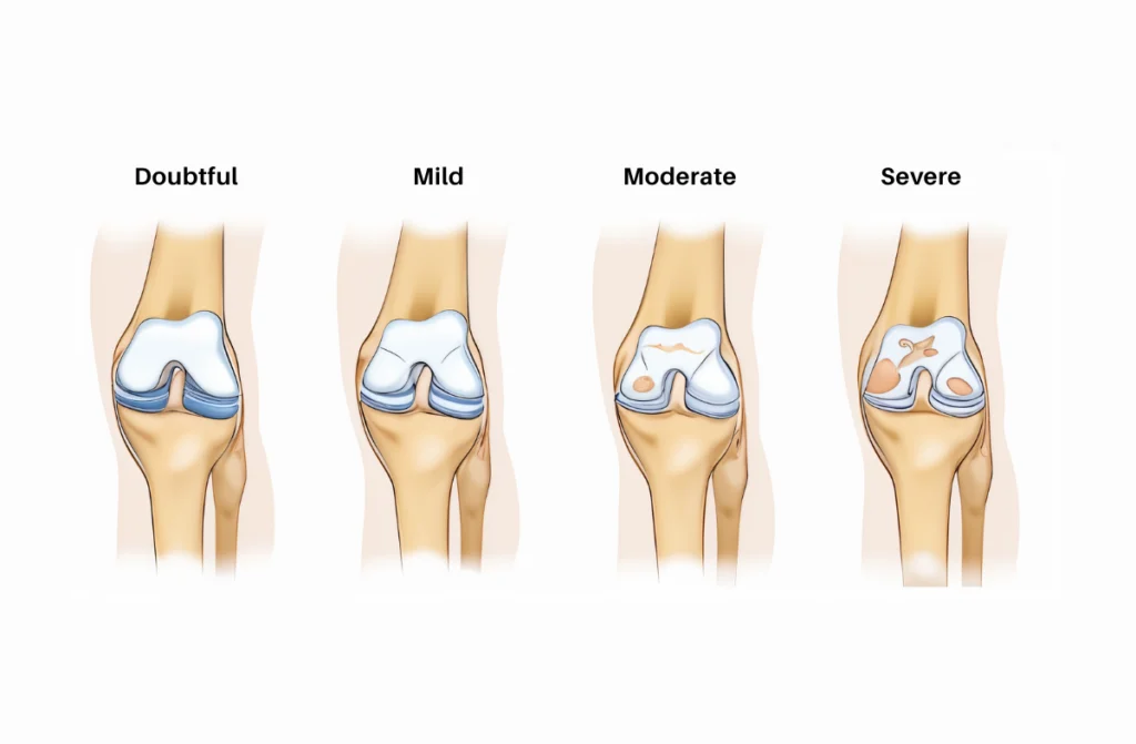 Best Orthopedic Treatment in Chennai
